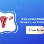 Understanding Fibroids: Causes, Symptoms, and Treatment Options