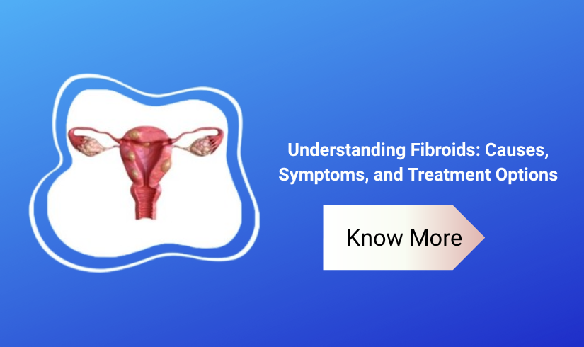 Understanding Fibroids: Causes, Symptoms, and Treatment Options